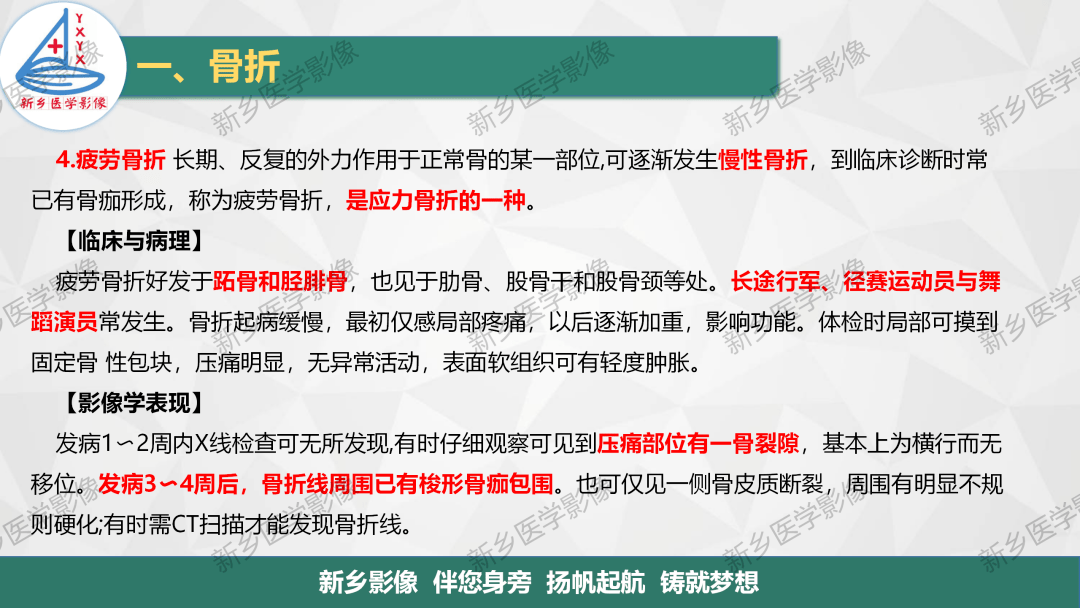 骨骺损伤及常见各类骨折的分型及诊断