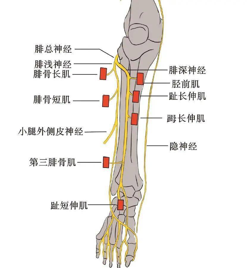 小腿疼痛的原因和治疗原则_肌肉_损伤_运动