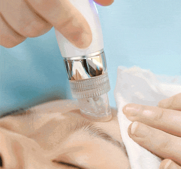 是真的0元get光子嫩肤效果太绝了