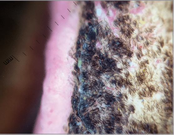 喝了3个月的浓汤后,他的舌头上长出了黑色绒毛_乳头_大叔_食物