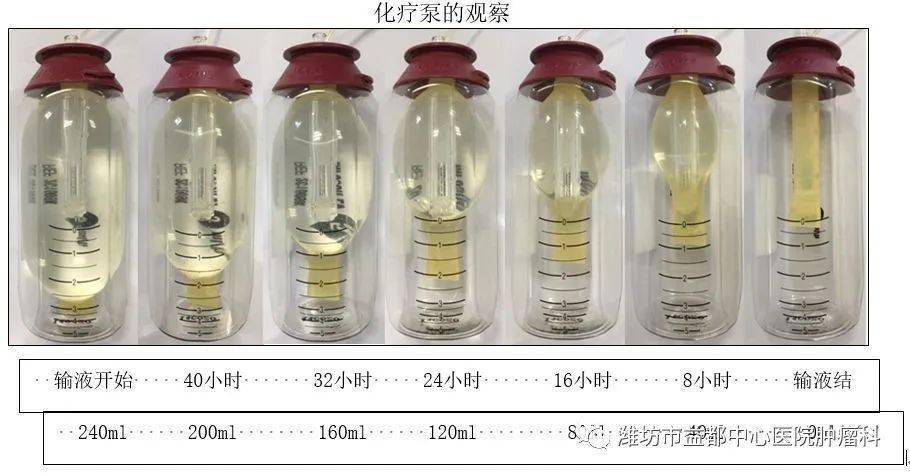 化疗泵种类图片