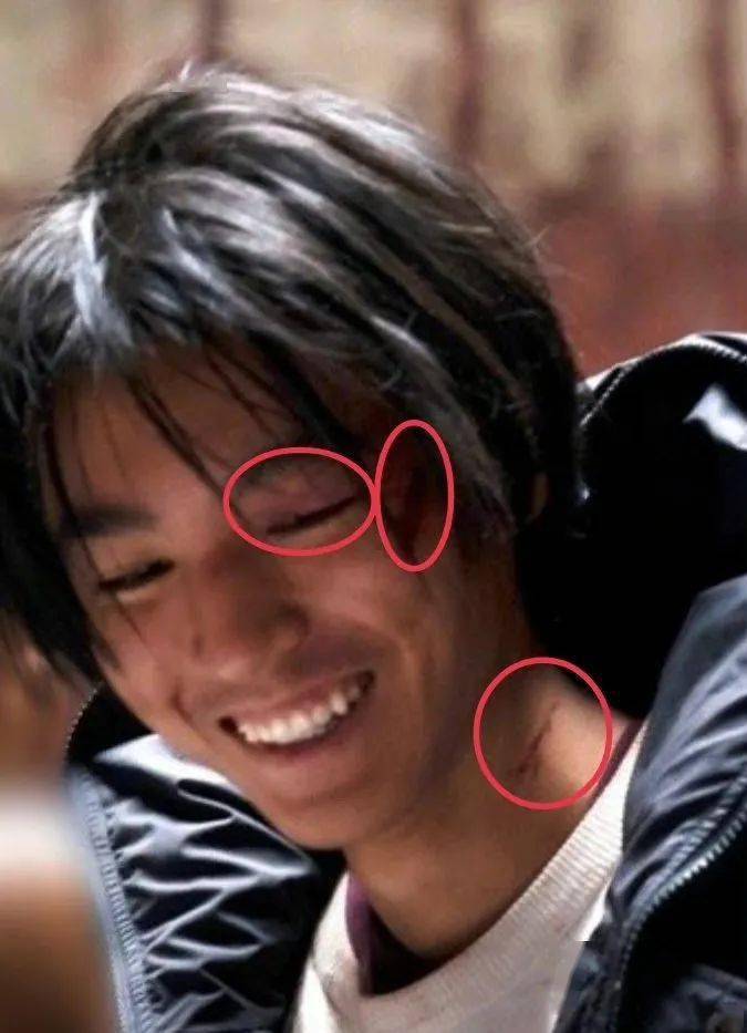 王俊凯脖子上的草莓印图片