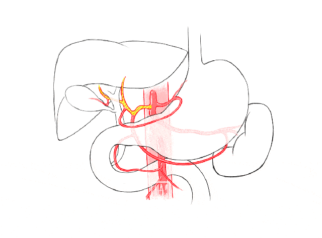 胰腺癌从确诊到死亡不足2个月3个症状可能都是它的脚步声