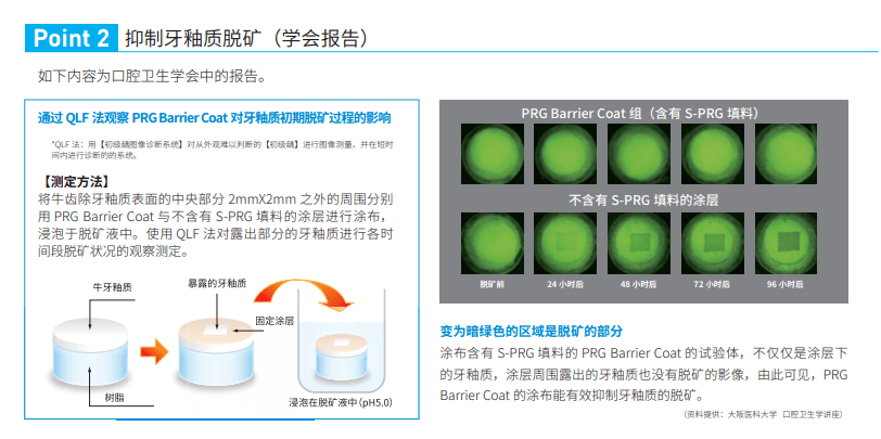 (点击了解松风后牙树脂)