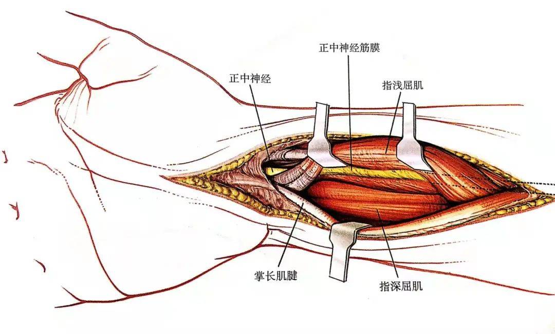 圖文詳解腕關節掌側入路