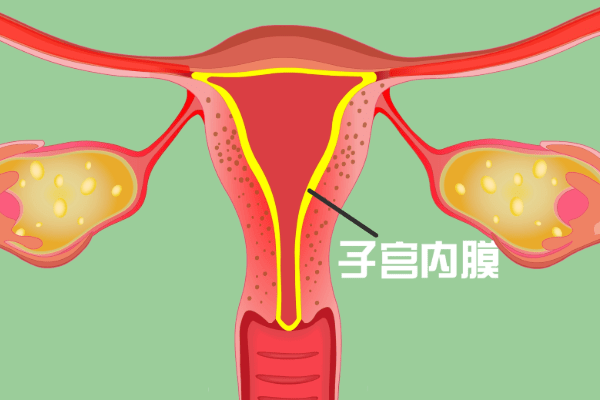 子宫内膜太薄该怎么调理?