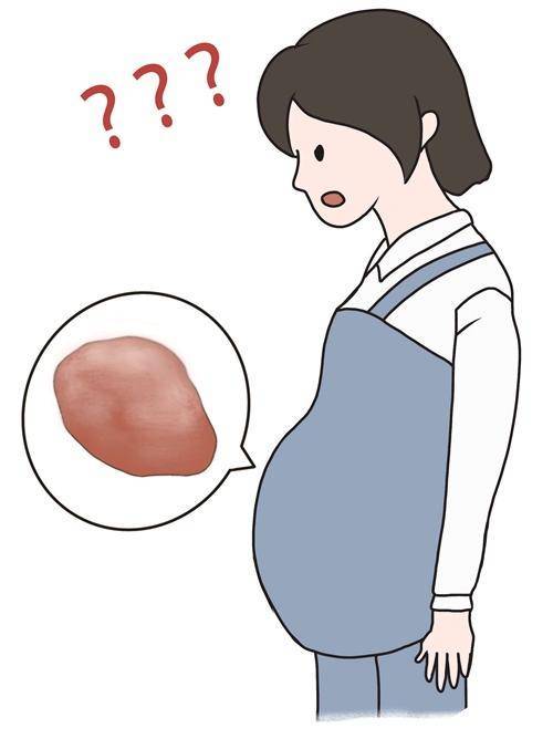 畸胎瘤和怀孕无关,定期体检有助早发现