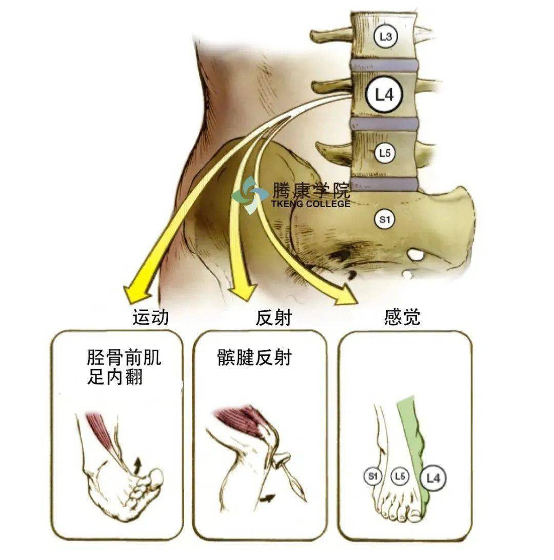 【总结】脊神经根损伤的评估:肌节,皮节和骨节