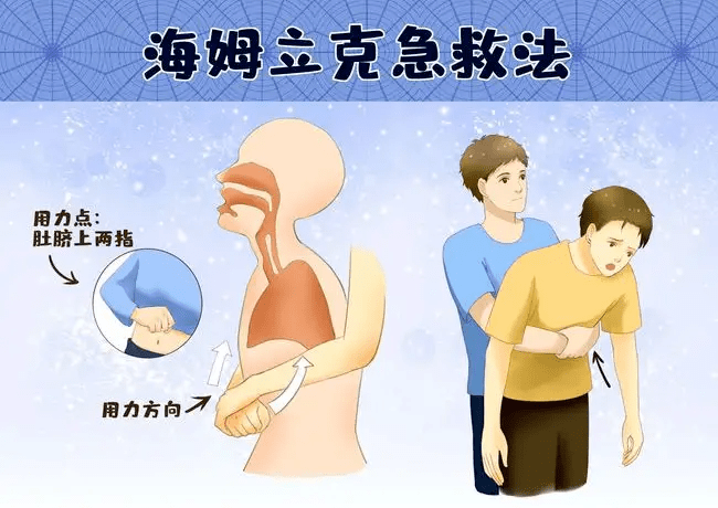 急救小课堂▏海姆立克急救法关键时刻能救命