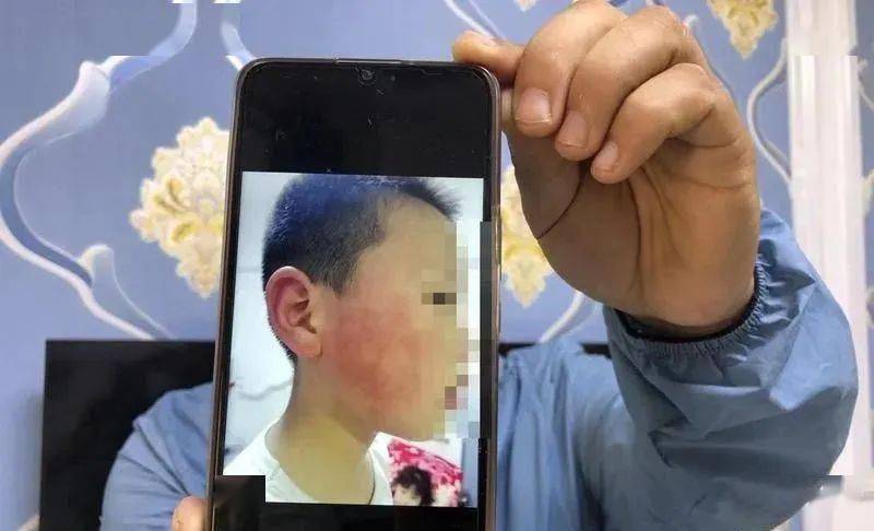 离谱西安男子掌掴7岁男孩致其鼓膜穿孔疑因男孩骑车时挤碰到男子