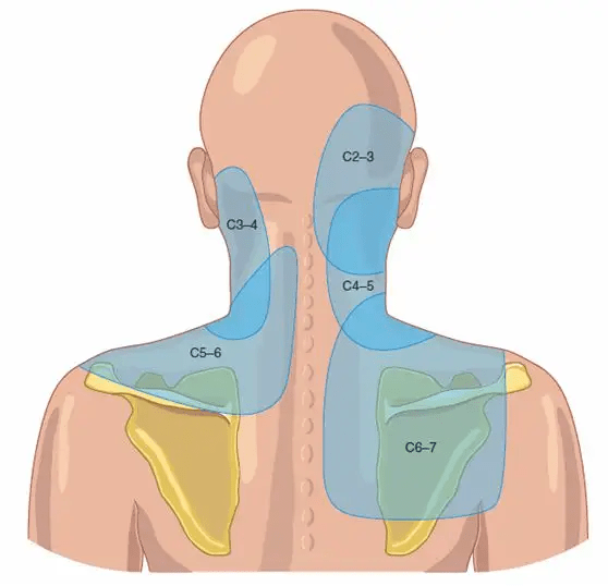 医文医话吴彦生头颈疼痛怎么办脉冲射频显奇效