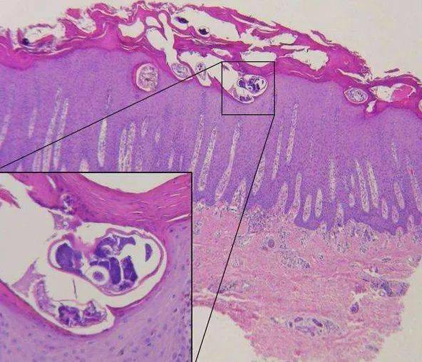 可以基本覆盖常见几种皮肤病可以治疗因蠕形螨,疥螨导致的
