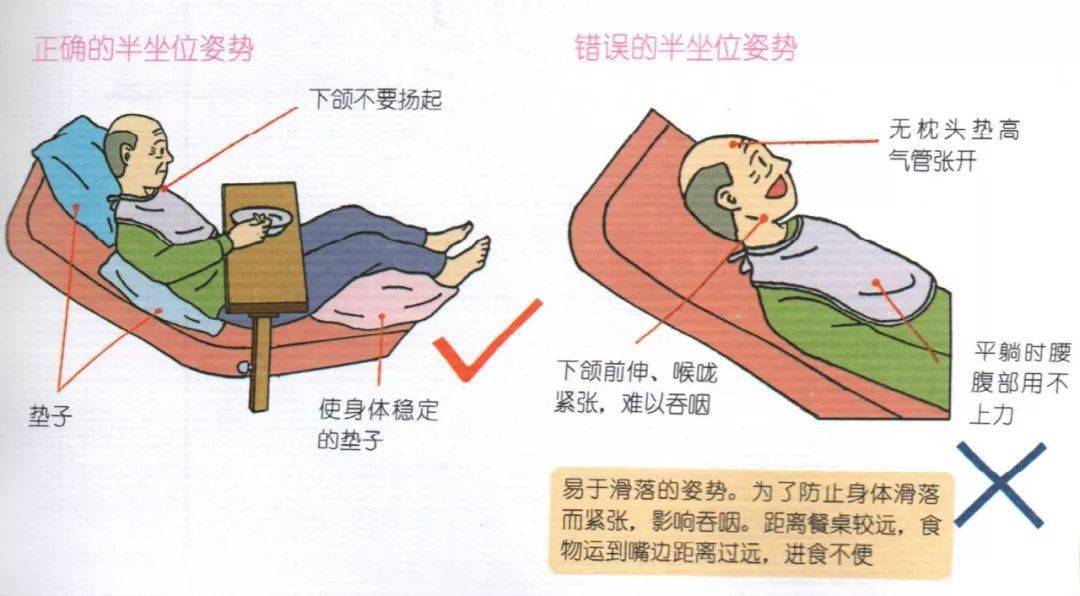 半护理,全护理长者床上进食的照护喂食的方法:无法保持稳定的坐姿时