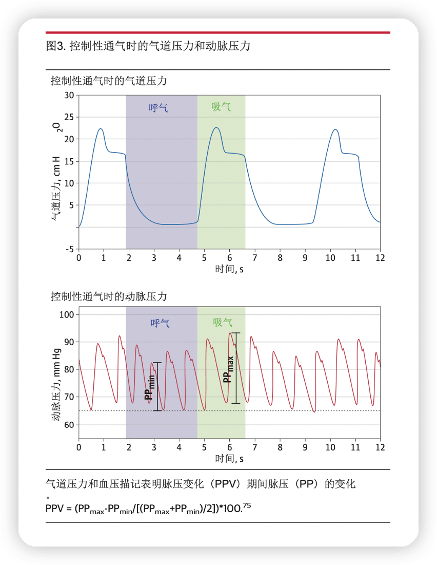 正常人血压脉搏曲线图图片