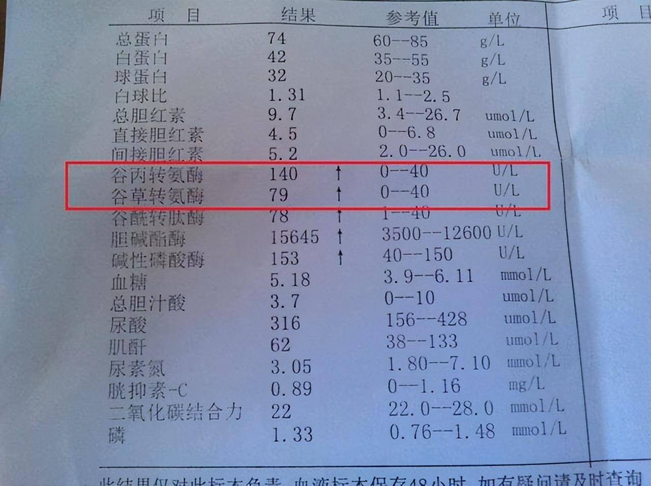 通常体检中主要检查的转氨酶是丙氨酸转氨酶,1%的肝脏细胞损害,可以使