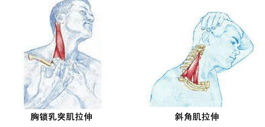 拉伸:胸鎖乳突肌,前中斜角肌動作要點:每側維持 30 秒,重複 3 次