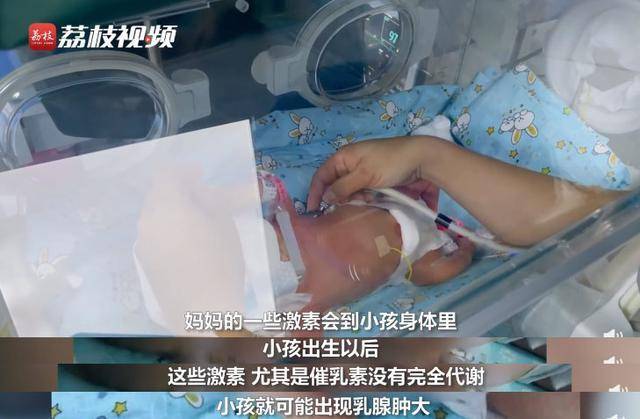 家长挤压9天宝宝乳房致急性乳腺炎,分享3个常见新生儿现象及正确护理方法