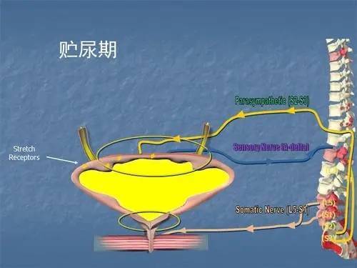 糖尿病併發症導致排尿困難,神經源性膀胱怎麼治?_治療_患者_排尿功能