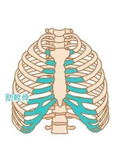 肋软骨炎示意图图片