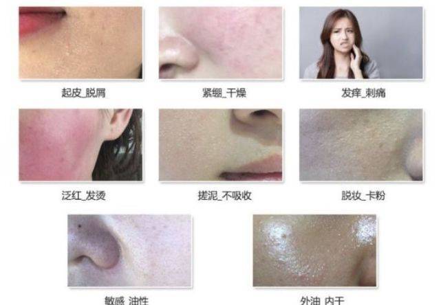 男生油敏皮怎么护肤?男士油皮水乳+男士洗面奶敏感肌怎么选?_皮肤_珂润_舒敏