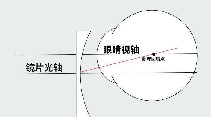 了解配镜中的前倾角_镜片_眼镜_影响