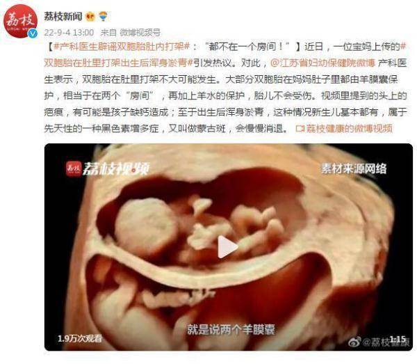 对此,江苏省妇幼保健院产科医生表示,双胞胎在肚里打架不大可能发生