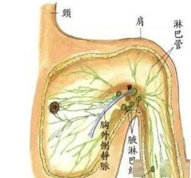 乳房淋巴结的位置图片图片