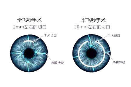 医学验光配镜：从模糊到清晰