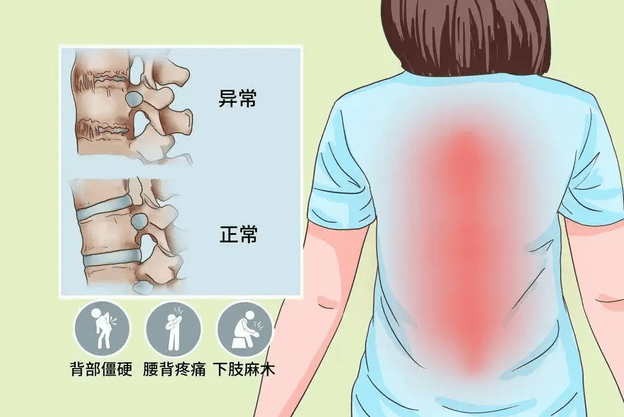 骶骨x线解剖图图片