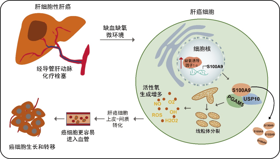 找到提高肝細胞癌療效的新幹預方向!