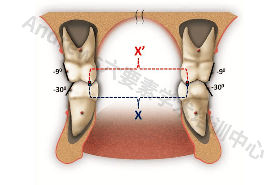 颌面协调六要素"在正畸治疗效果评价中的应用_矫治_相关研究_andrews