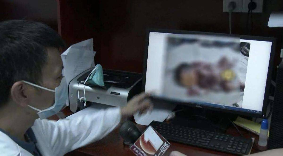 也曾是一条小生命_胎儿_手术_医生