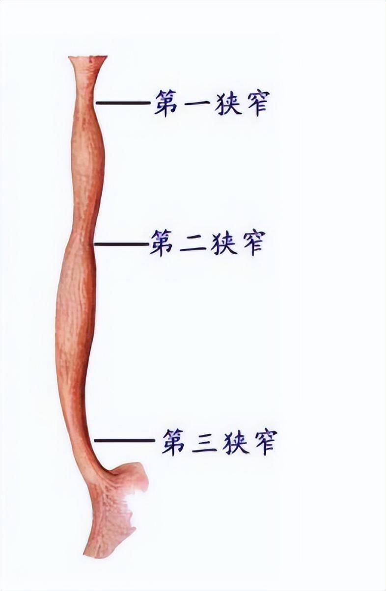 女子吃饭时身亡