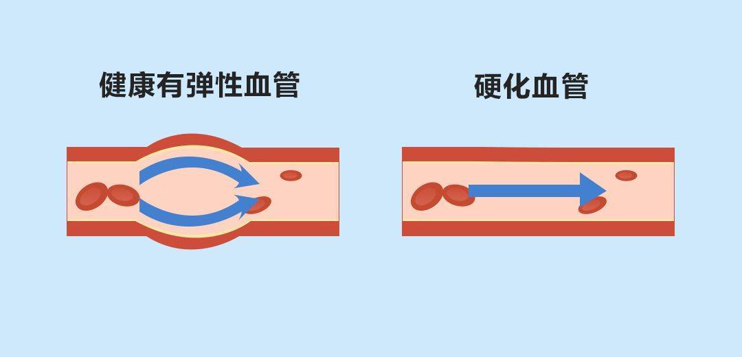 图片[4]-珍奥健康知识科普：神奇的微循环吃喝拉撒都离不开它 - 血管微语-血管微语