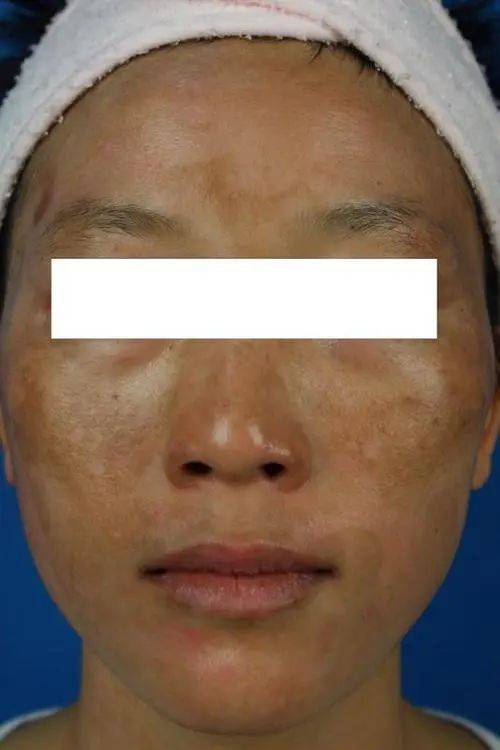 女性若有2处“发黑”，或是子宫承受不住“寒冷”，劝你早做调理_宫寒_病症_健康状况