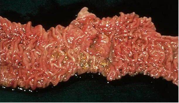 匡宝晓:猪场回肠炎的防控措施_劳森_临床_发病