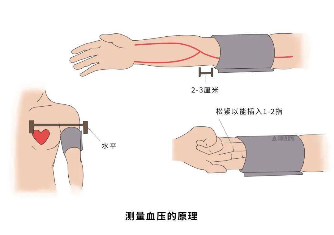 肱动脉搏动处图片