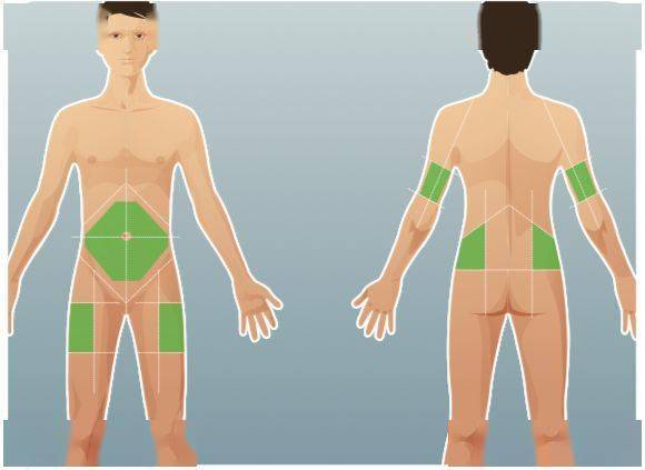 打胰岛素手臂位置图片图片
