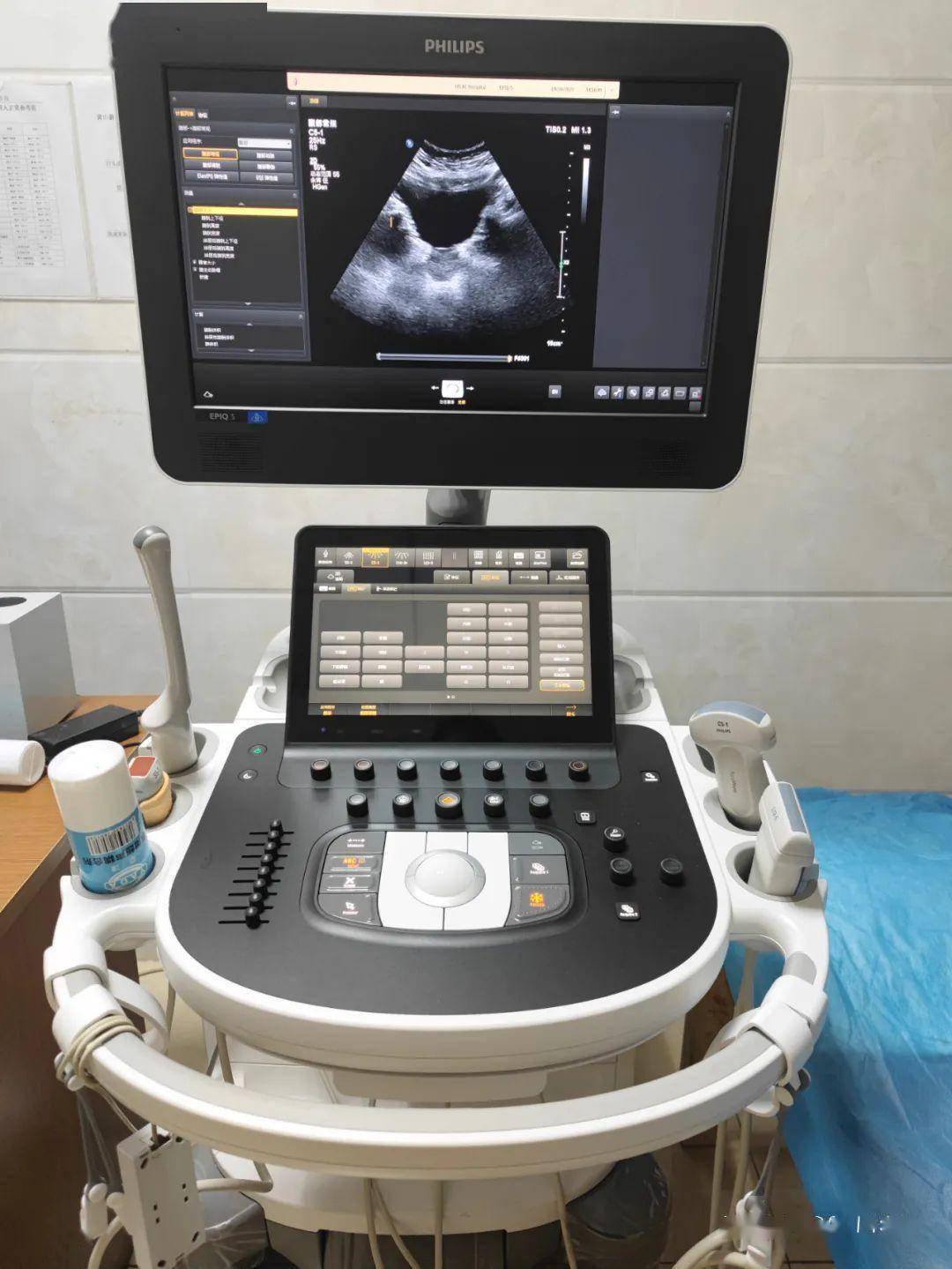 新晨医院新引进的高端设备飞利浦epiq5彩超投入使用_检查_超声_学科