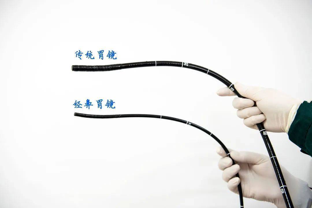 胃镜_治疗_诊断