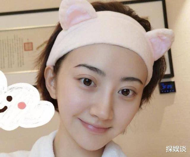 景甜现身医美医院被拍,回家路上还换两次车_双眼皮_网友_明星