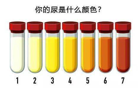 正常尿液颜色对照图片图片