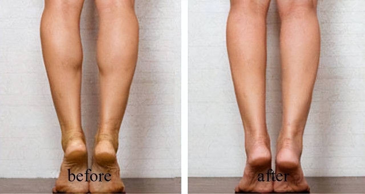 让腿部分泌大量高浓度代谢物,乳酸堆积回