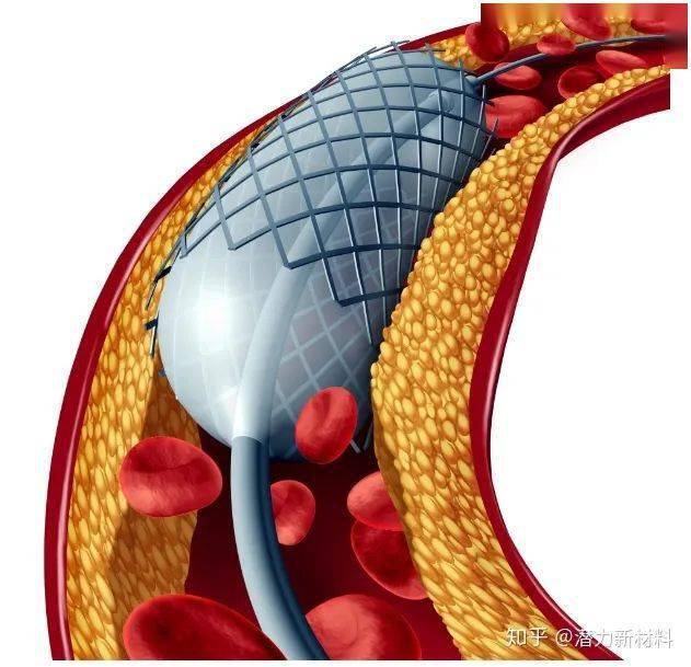 材料圆桌|记忆金属是什么?_温度_应用_领域