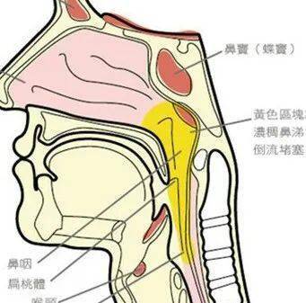 后鼻孔位置图片图片