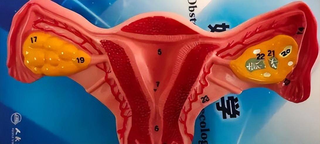 一个夜班接了3个急诊,都是黄体破裂,黄体是什么?