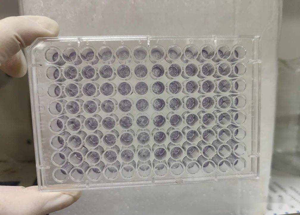 细胞表型 | 细胞增殖②mtt实验