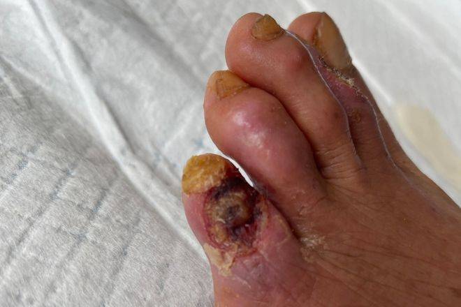 爷爷_患者_进行