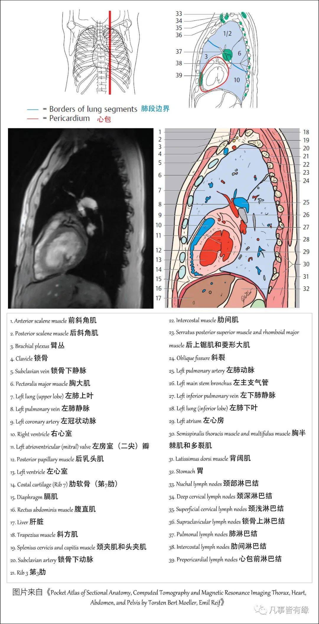 【保藏】胸部的断层剖解