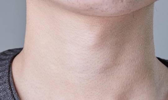 告诉你良策_水平_女性_补充